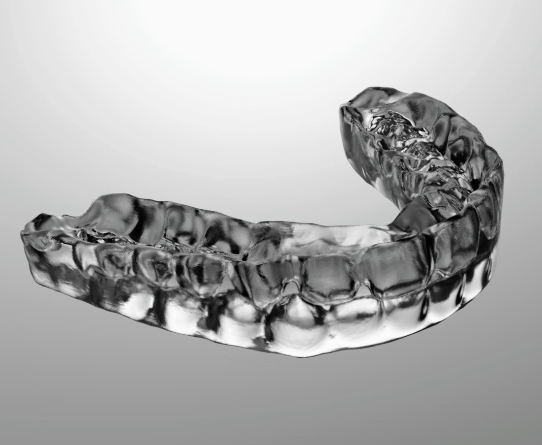 Tooth positioner individualisés imprimés en direct. AFOND.FR